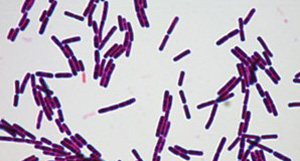 阿姆斯为您揭晓<i style='color:red'>生物菌肥</i>是不是含菌量越高越好呢